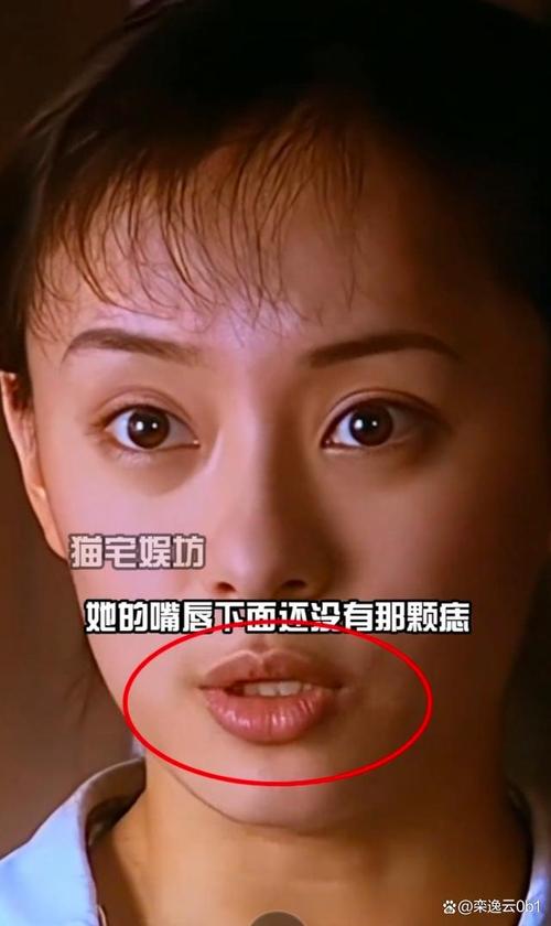 澳门研究生最新资料和孙俪唇下痣没了与孙俪嘴唇的痣