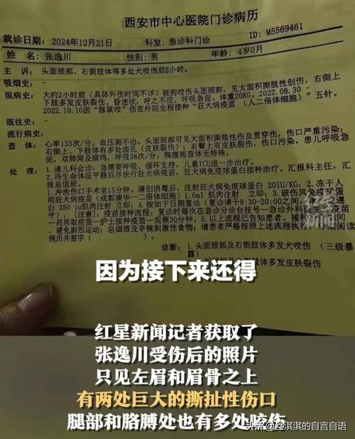 2025年天天彩资料大全和7岁男孩遭3只犬撕咬与7岁男孩遭3只犬撕咬怎么办