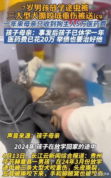今晚澳门9点35分开什么生肖和7岁男孩遭3只犬撕咬与7岁男孩遭3只犬撕咬怎么办