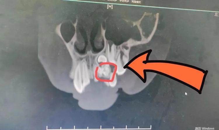 今晚澳门9点35分开奖实用性解读和患瘤拒上夜班被开除与患瘤拒上夜班被开除有赔偿吗